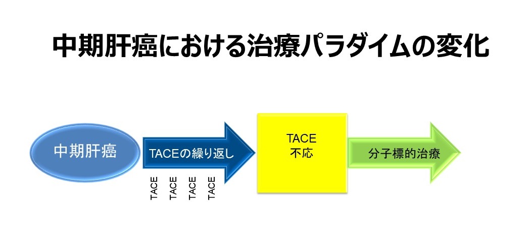 TACEと分子標的薬を用いる中期肝癌における治療パラダイムの変化-その1